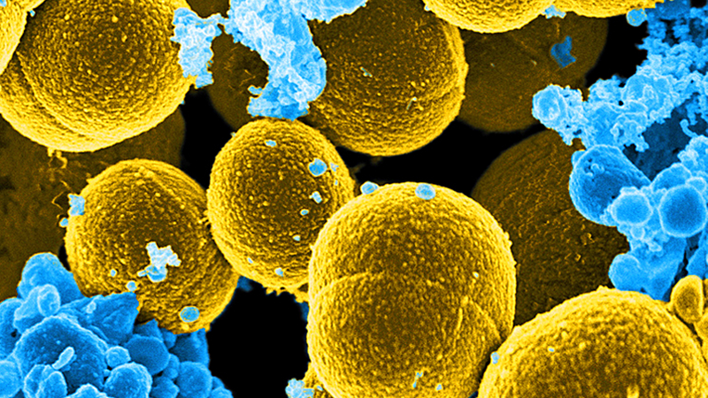 Skin bacteria. (Image: AP)